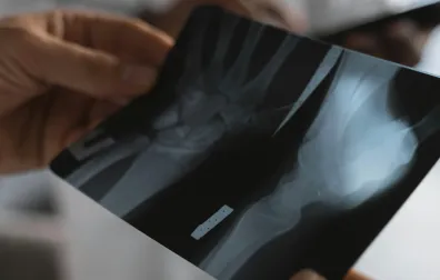 Röntgenfoto van kraakbeen en gewrichten