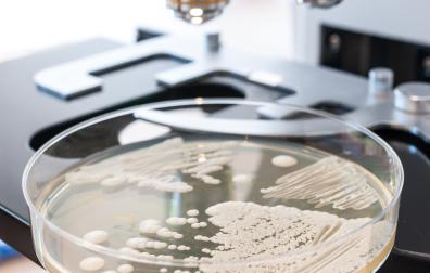 Microscoop met bakje met schimmels