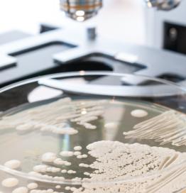 Microscoop met schimmel in bakje